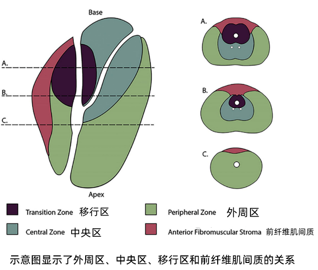 前列腺增生病友的影像学检查怎么选