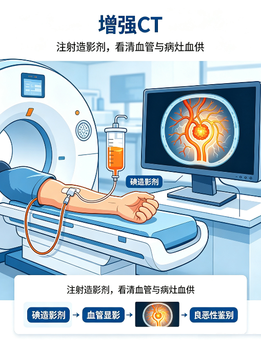 对比剂：影像科的"荧光笔"